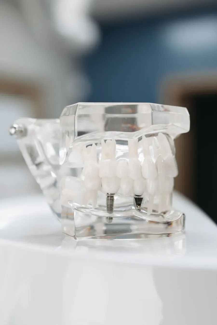 Diş implantı anatomik modeli